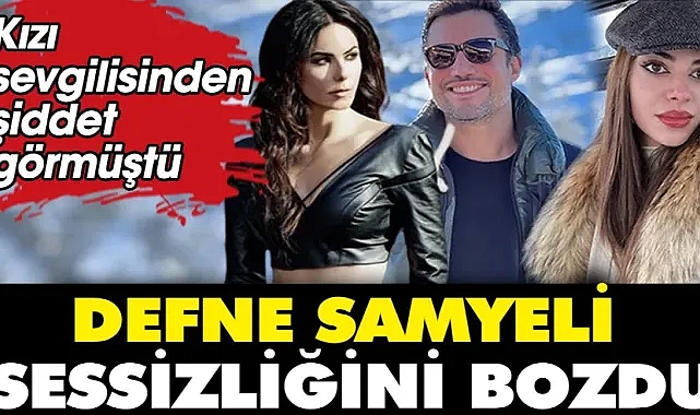 Defne Samyeli: Kızım Derin sevgilisi tarafından darp edildi